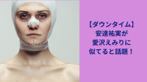 ダウンタイム安達祐実